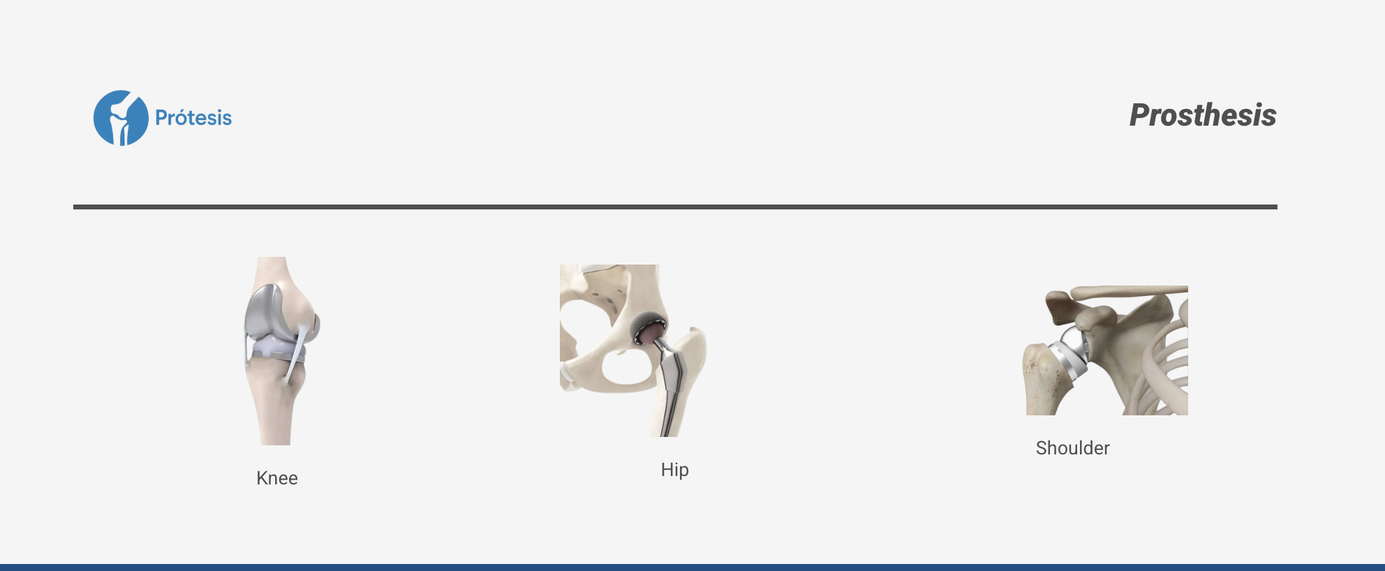 Prosthesis - Knee, Hip, Shoulder